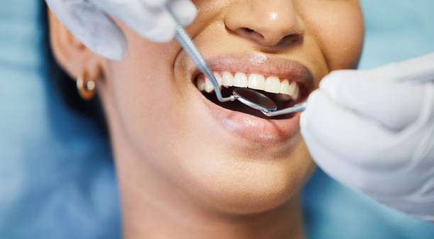 Emergency Dental Filling Replacement in NE