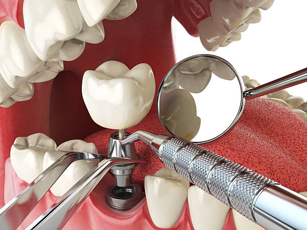 Best Cracked Tooth Emergency Dentist  in Bellevue, NE